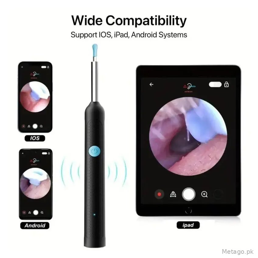 Smart Visual Ear Wax Cleaning Kit with HD Camera