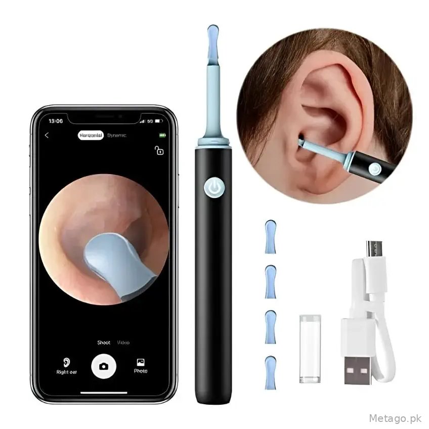 Smart Visual Ear Wax Cleaning Kit with HD Camera